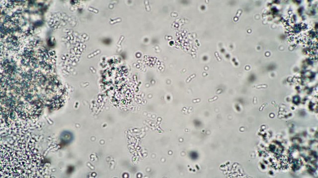 Microscopic milk bacilli float in the leaven in the microscope. Theme of foods background is under 1000x magnification. Milk product such as kefir or yogurt. Microcosmic background.