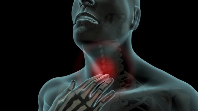 Sore Throat