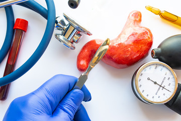 Concept photo of stomach or gastric surgery. Doctor with scalpel in his hand makes an incision in...