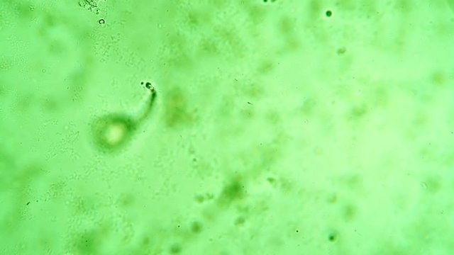 Focus on stem of a single infusoria vorticella in colored water. Theme of laboratory biological research under microscope. Microscopic protozoa in a drop of water magnification. Microcosm background.
