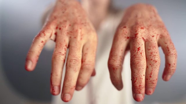 Beaten woman's hands in blood, serious body trauma after car or motorcycle accident. Close-up of bleeding fingers, injured female patient in hospital waiting for first aid. Accident victim, planning