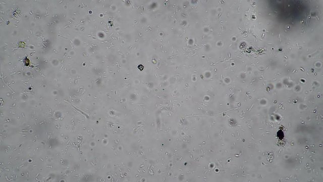 Microcosmic background of the bacteria of the bacilli and a variety of protozoa. Theme of laboratory biological research under microscope. Microscopic protozoa in a drop of water magnification.