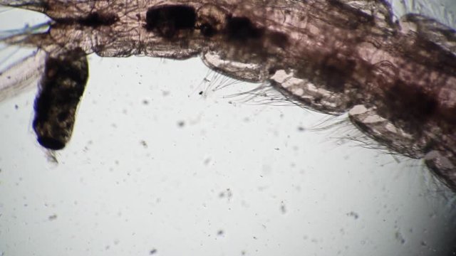 Defecation of the microorganism from the worm in microscope. Theme of micro biology and scientific microscopy. Microscopic protozoa in a drop of water magnification. Microcosm background.