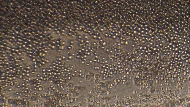 Microscopy of yeast cells (Saccharomyces cerevisiae). Magnification 300x with visible cells of granule shape. Rapid movement of cells due to lack of nutrition and space.