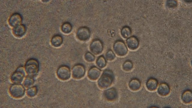 Microscopy of yeast cells (Saccharomyces cerevisiae). Magnification 900x with visible cells of granule shape. 