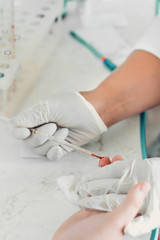 Closeup of blood sampling from finger, lab technician and patient hands.