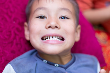 the boy laughs and shows the first tooth. children's teeth, loss and fingers are directed to the incisors, the baby’s mouths are close-up, the baby’s tooth cutter is absent