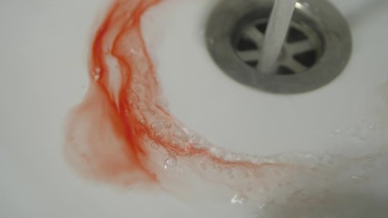 Blood and spit splatter on a sink - Powered by Adobe
