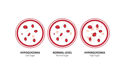 Glucose blood level sugar test. vector illustration