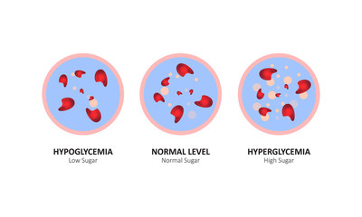 Glucose blood level sugar test. vector illustration