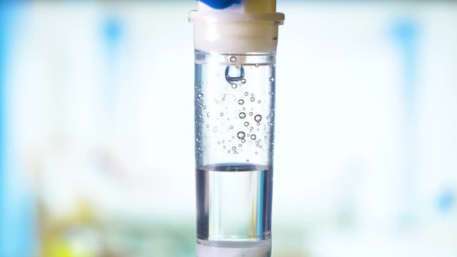 Dripping medical perfusion close up equipment in clinic background. Drip Fluid for Infusion in Hospital. Macro Drop of Medical Perfusion. Intravenous Treatment in a Hospital 