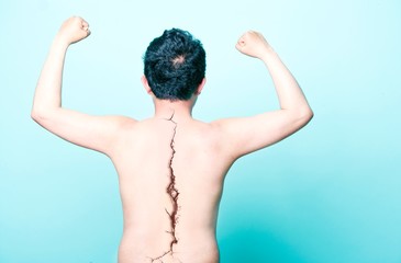 Bare back of man with a crack on spine