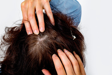 Woman controls head on hair loss