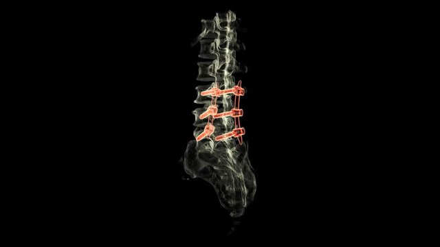 Fragile Glass Vertebrae On A Black Spinal Cord A Conceptual 3d Render  Background, Backbone, Human Spine, Spine Background Image And Wallpaper for  Free Download