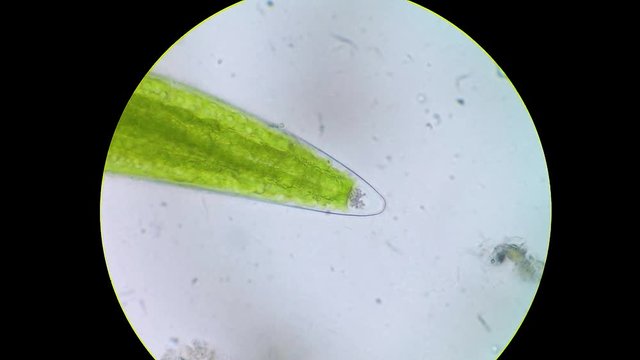 Close of microcrystal orb of Closterium algae