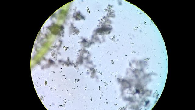 Living diatoms in benthic pond water
