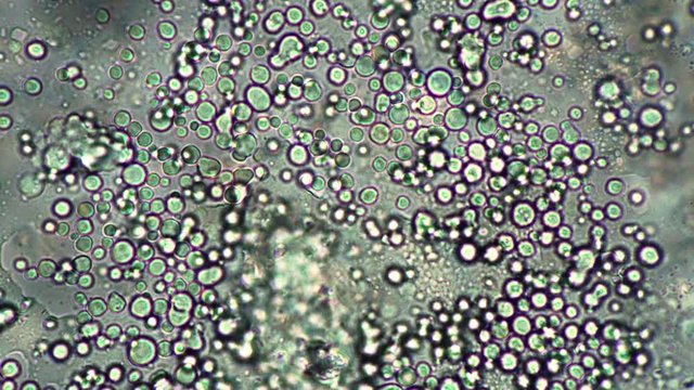 Mobile bacteria from fermented milk product microcosmic background. The theme of lactic acid foods is under 1000x magnification. Bacteria useful for human body from yogurt in a microscope.