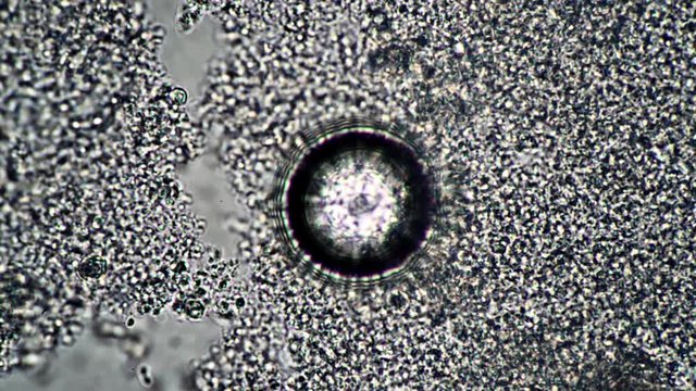 Abstract round object in a microscope focus adjustment. The theme of lactic acid foods is under 1000x magnification. Bacteria useful for the human body from yogurt. Microcosmic background.
