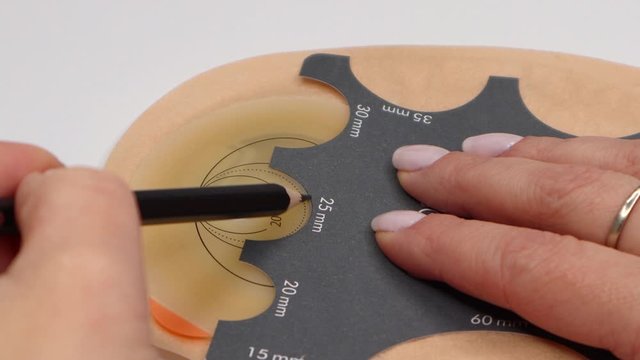 Colostomy bag, supply needed after colostomy surgery - colon cancer treatment. Ostomy bag in skin color. Medical theme. Stoma bag ready to use. Drawing hole for cutting opening with stoma guide.