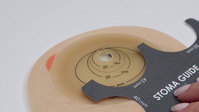 Colostomy bag, supply needed after colostomy surgery - colon cancer treatment. Ostomy bag in skin color. Medical theme. Choosing the correct size for opening with stoma guide.