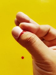 The man's hand had a wound from a knife with a blushing blood on a yellow background.
