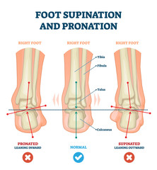 Fototapeta Foot supination and pronation vector illustration. Labeled medical scheme. obraz