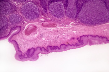 Palatine tonsil cross-section of a domestic cat (Felis catus Linnaeus, 1758) - permanent microscope slide (stained by haematoxylin-eosin)