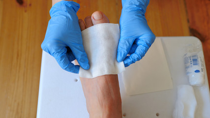 Fototapeta premium Nurse is putting antiseptic dressing at the wounded foot