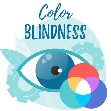 Color Blindness Vector Flat Concept. Daltonism. Optometry, Ophthalmology Vector Flat Illustration.