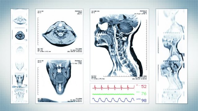 Neck MRI Scan. White. 3 videos in 1 file. Animation showing top, front, lateral view and ECG display. Each video is loopable. Medical Background. More options in my portfolio.