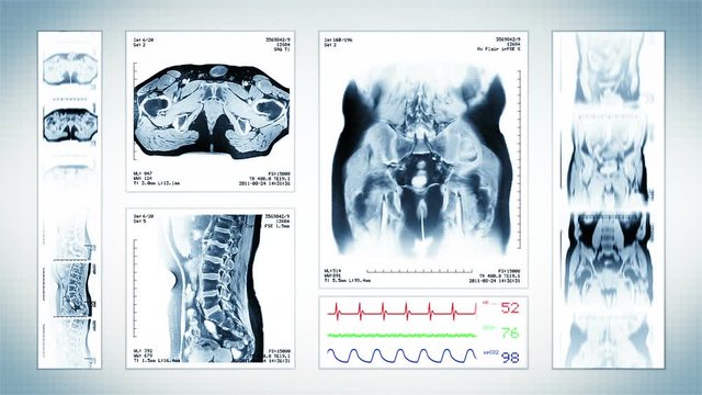 Pelvis MRI Scan. White. 4 videos in 1 file. Animation showing top, front, lateral view and ECG display. Each video is loopable. Medical Background. More options in my portfolio.
