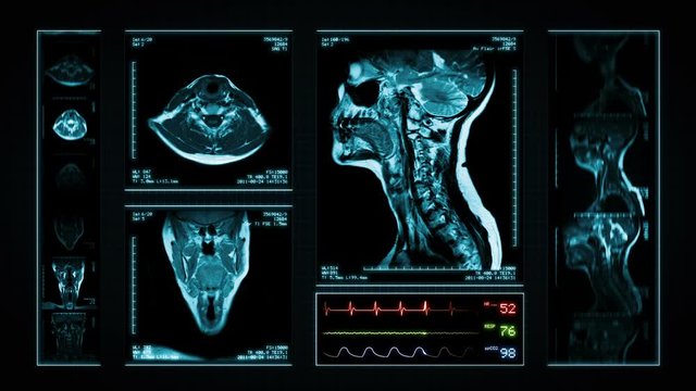 Neck MRI Scan. Blue.  3 videos in 1 file. Animation showing top, front, lateral view and ECG display. Each video is loopable. Medical Background. More options in my portfolio.