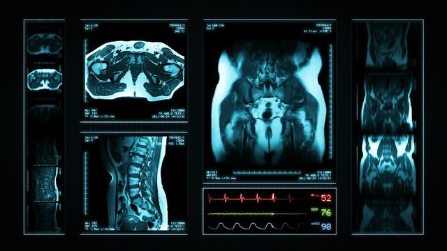 Pelvis MRI Scan. Blue. 4 videos in 1 file. Animation showing top, front, lateral view and ECG display. Each video is loopable. Medical Background. More options in my portfolio.
