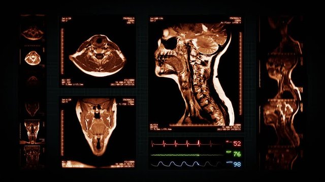 Neck MRI Scan. Amber. 3 videos in 1 file. Animation showing top, front, lateral view and ECG display. Each video is loopable. Medical Background. More options in my portfolio.