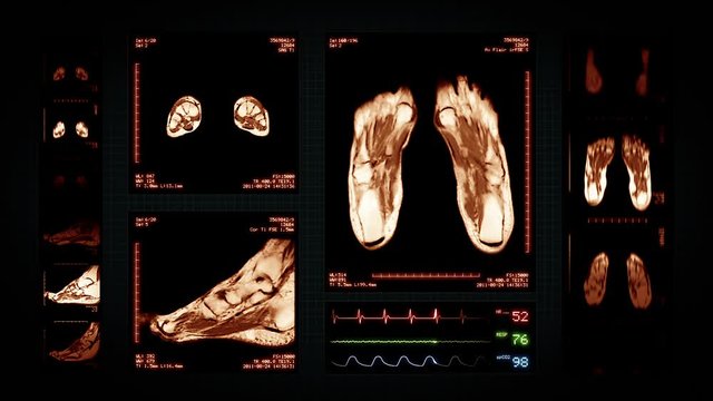 Foot MRI Scan. Amber. 3 videos in 1 file. Animation showing top, front, lateral view and ECG display. Each video is loopable. Medical Background. More options in my portfolio.
