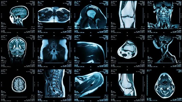 Multiple MRI video wall. Black and white. Loopable. Locked down. 2 videos in 1 file.  Composite video showing multiple MRI images incluiding: head, neck, arm, foot, pelvis, etc. 
