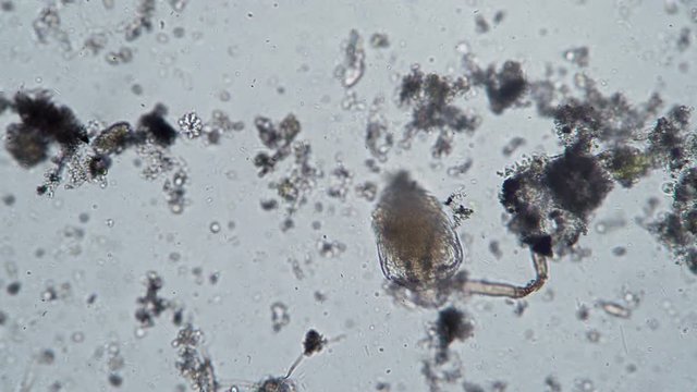 Big rotifer close-up in dirty water microscopic background. Theme of laboratory biological research under microscope. Microscopic protozoa in drop of water magnification. Microcosmic background