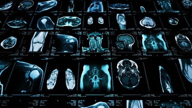 MRI video wall. Black and white. Loopable. Frontal view. 2 videos in 1 file. Composite video showing multiple MRI images including: head, neck, arm, foot, pelvis, etc. More options in my portfolio.     