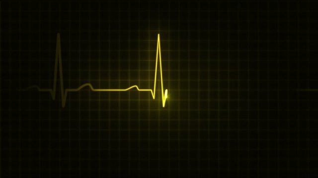 ANIMATION DESIGNED AND CREATED BY ME FROM SCRATCH.Electrocardiogram. Loopable. 3 in 1. Yellow. Heartbeat waves showing 3 conditions: tachycardia, healthy heartbeat and loose of heartbeat. 