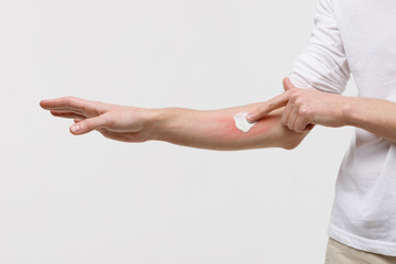 Bouts of allergies concept. Allergic reaction, itch, dermatitis, dry skin. Man is applying...