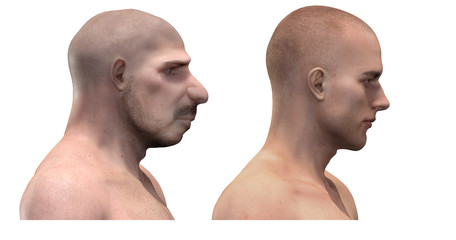 Neanderthal vs modern human