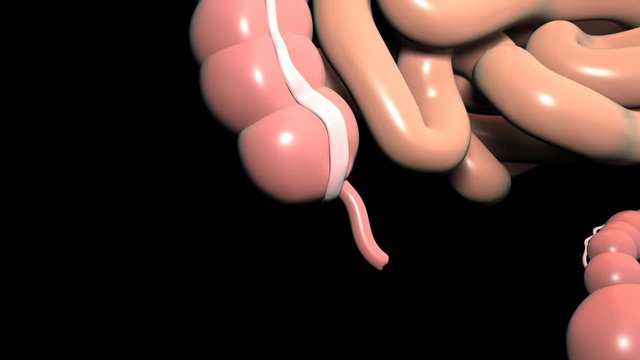 Appendix Inflammation