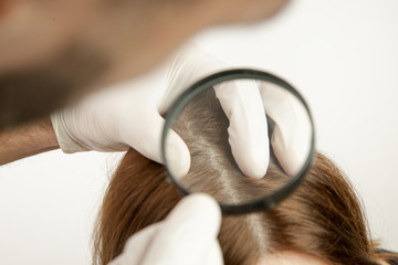 Doctor examining womans hair scalp, scalp eczema, dermatitis, psoriasis, hair loss, dandruff or dry...
