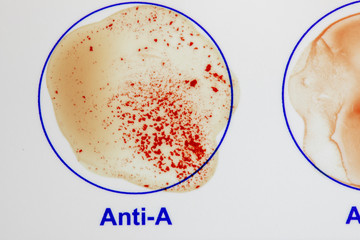 Antibody A blood agent test