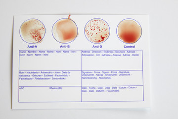 Home blood type testing for type A+