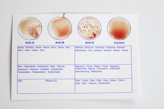 Home blood type testing for type A+