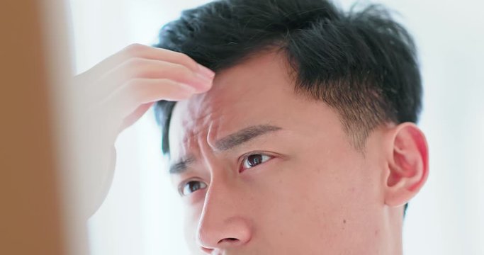 man worried for hair loss