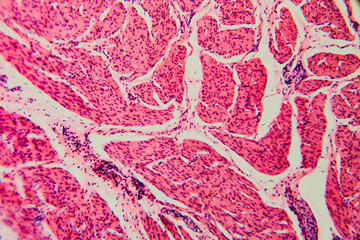 Nature background- cell bladder cat