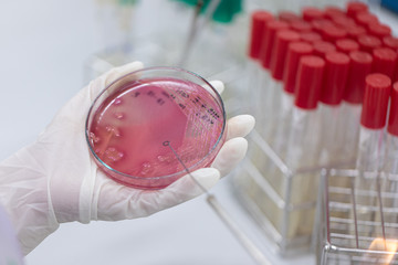 Streak plate for Bacteria culture or identify Bacteria research in labmicrology.