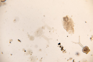 Study Movement and Specimens of Transversotrema patiallensis (parasite) under the microscopic in laboratory.